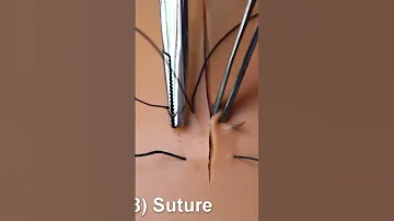 188.Figure of 8 suture #technique of suturing #dental procedure  #dentist #surgeryeducation #stitch