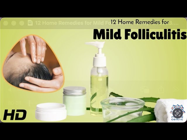 Folliculitis Care at Home: 12 Remedies That Actually Work!
