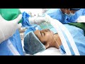 Girl Going under Deep Sleep with Anesthesia