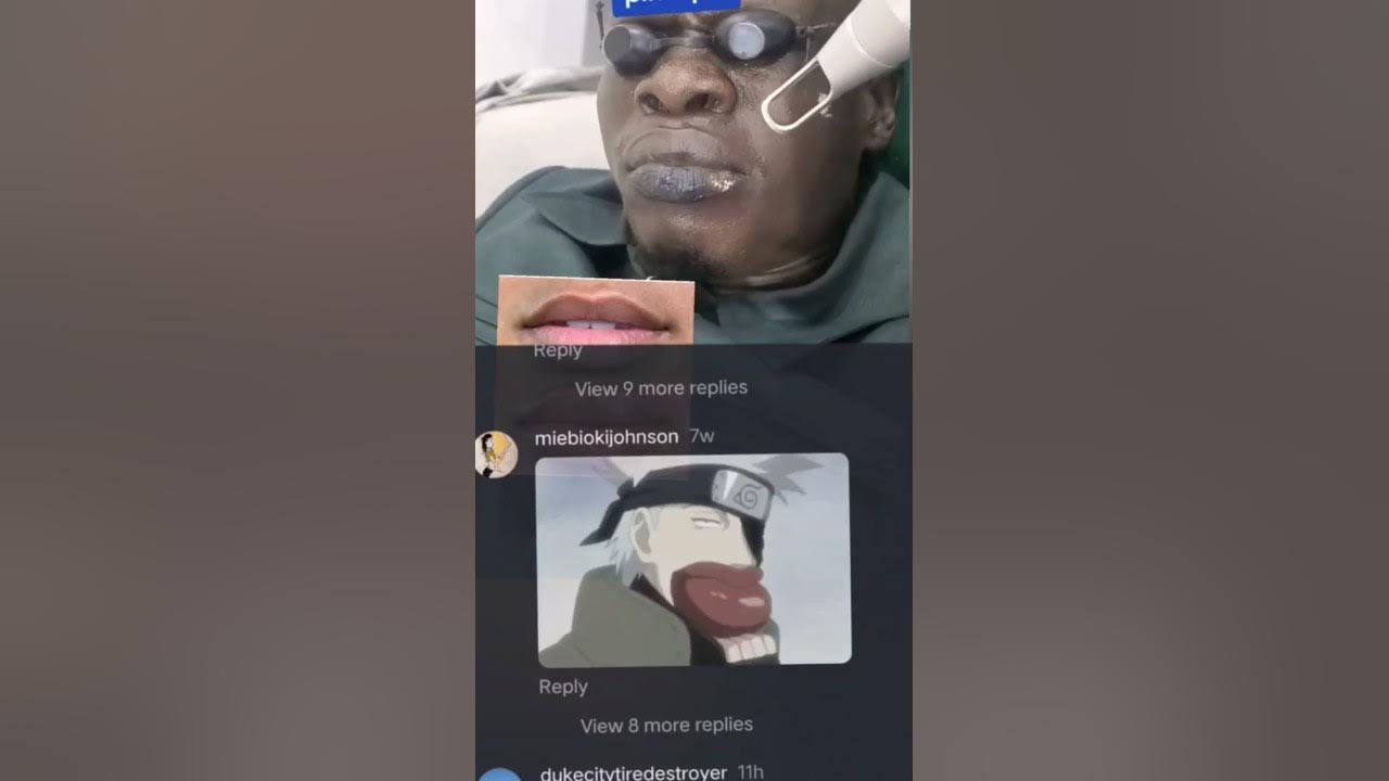 watch-painful-pink-lips-laser-treatment-procedure-funny-comments