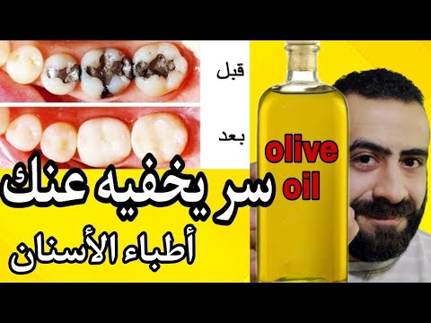 تجربتي مع المضمضة بالزيت لعلاج تسوس الاسنان و انحسار اللثه لماذا يخفي اطباء الاسنان سرها