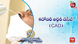 Coronary Artery Disease (CAD) | కరోనరీ ఆర్టరీ డిసీజ్ (CAD) | Aarogyamastu | 12th Aug 2022 | ETV Life