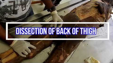 Dissection of Back of Thigh