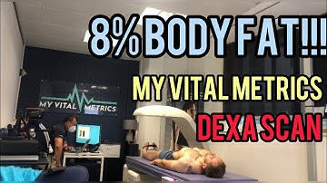 The LEANEST Guy in LONDON! Most accurate body fat test (dexa scan & 3D imaging) at My Vital Metrics