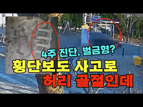 허리가 부러지는 사고를 당했는데, <strong>벌금형</strong>?? 진단서 때문입니다!!