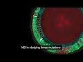 Research to Prevent Lens Detachment