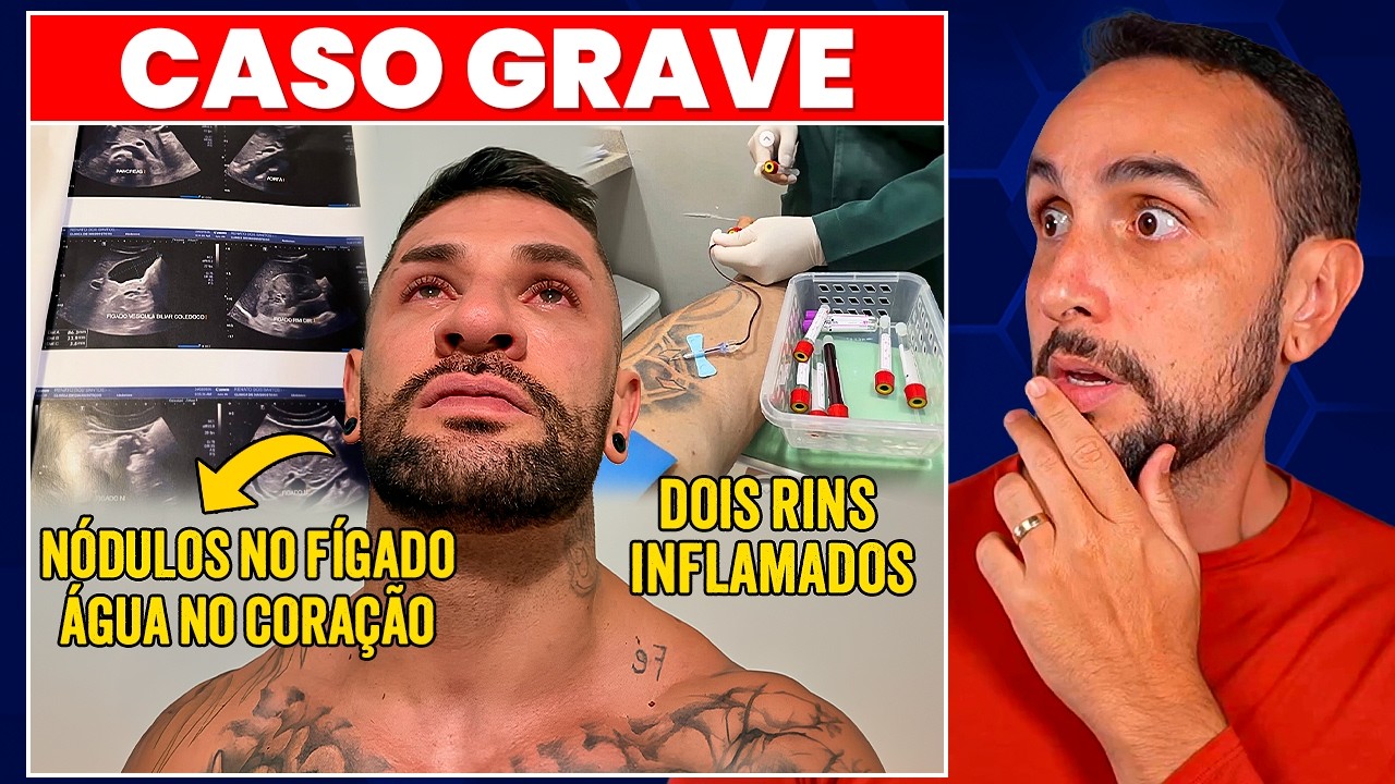 POBRE LOCO - A SAÚDE PIOROU?