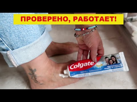 Намазала ЗУБНУЮ пасту на ноги, решила кучу ПРОБЛЕМ