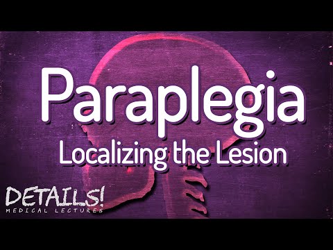 Paraplegia - Localizing
