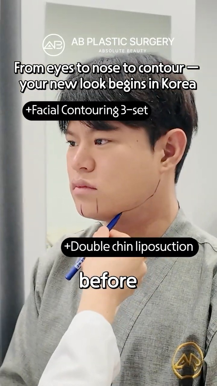 Why People Get Eyes, Nose & Contour Surgery in Korea #shorts