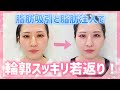 【若返り】kunoクリニック 顔の脂肪吸引脂肪注入 施術レポート【脂肪注入】