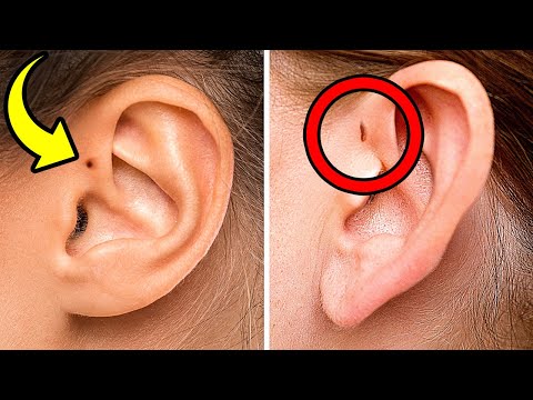 Video: Bagaimana daun telinga yang melekat diwariskan?