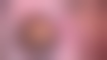 Tips for Malyugin Ring Pupil Expansion in Cataract Surgery