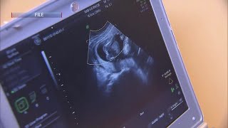 Central Coast residents react to California lawmakers’ vote to make abortions cheaper