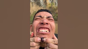 How I Cured a Bug Bite with Yogurt in theWild | Survival Hacks #tomatofight #shorts #funny