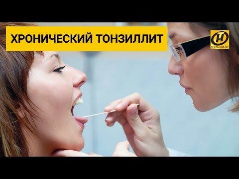 Как лечить хронический тонзиллит? Формула Здоровья