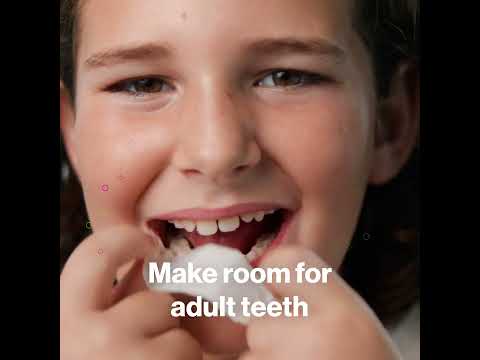 Invisalign Palatal Expander