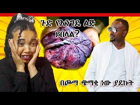 ቪዲዮ: ስሊም ምን ፍሬ ይበላል?