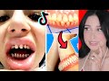 TIKTOKS QUE TE HARAN QUERER BRACKETS | Mariale