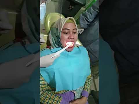 Video: Apakah cangkerang gigi?