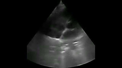 YJ C60 PLUS with phased array probe for cardiac