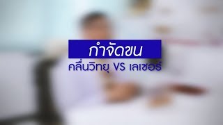 การกำจัดขนด้วย คลื่นวิทยุ vs เลเซอร์