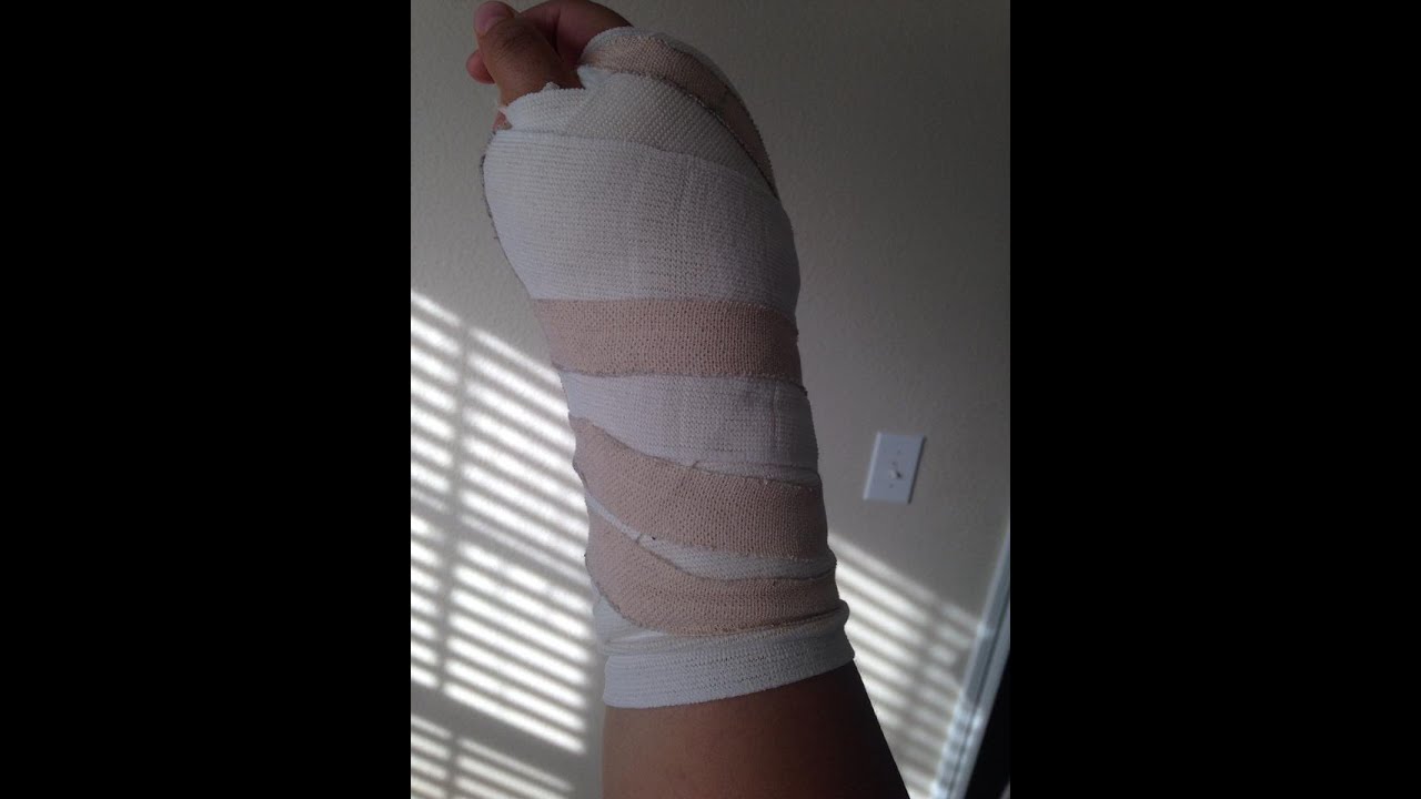 Hand Surgery YouTube