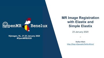 MR Image Registration with Elastix and Simple Elastix