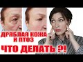 Дряблая кожа и птоз.  Что делать? Ч.1