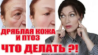 Дряблая кожа и птоз.  Что делать? Ч.1