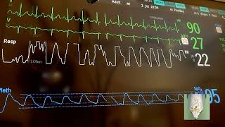 ΨΗΦΙΑΚΟΣ ΕΛΕΓΧΟΣ ΥΓΕΙΑΣ: Η ΕΥΡΩΠΑΪΚΗ ΕΝΩΣΗ ΣΤΗΝΕΙ ΕΝΑ «ΜΕΓΑΛΟ ΑΡΧΕΙΟ» ΠΟΛΙΤΩΝ