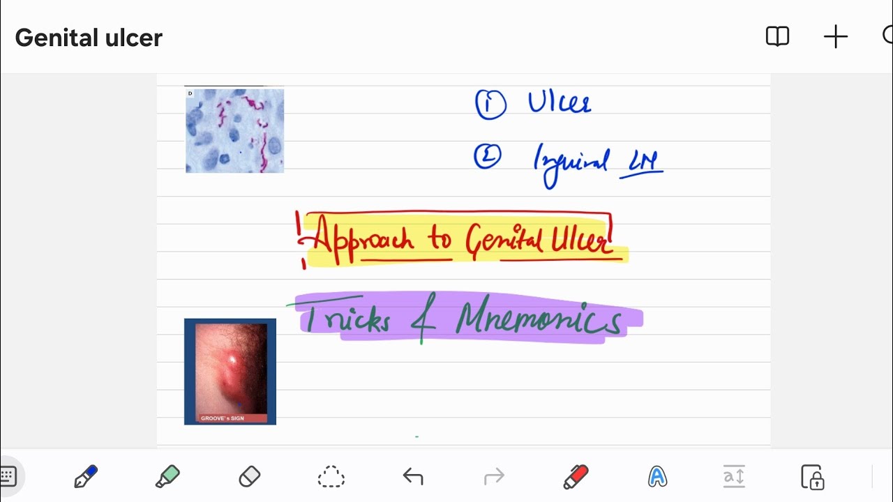 Approach to Genital Ulcer Tricks and Mnemonics || INICET NEET-PG PYQ / PYT || Derma Micro