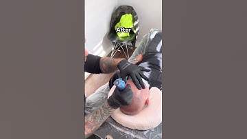 Men’s thinning hair treatment #scalpmicropigmentation #smp #hairlosssolution #hair #edmonton #hair