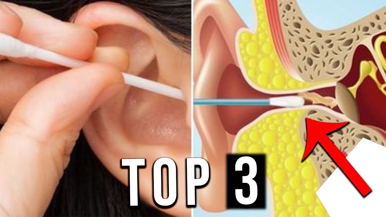 TOP 3 : Meilleur Kit Nettoyage Oreille de 2022 