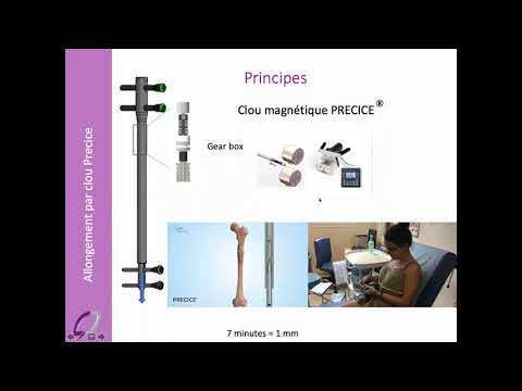 Vidéo: Qu'est-ce que l'allongement en radiographie?