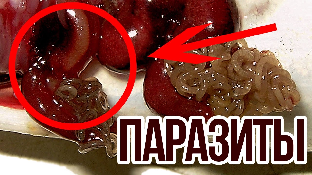 Семена льна от глистов и паразитов Семена льна от глистов и паразитов