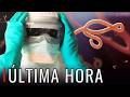 🔴 “PROTOCOLOS DE EMERGENCIA” Sospechoso de Ébola aislado en Europa tras viaje desde África