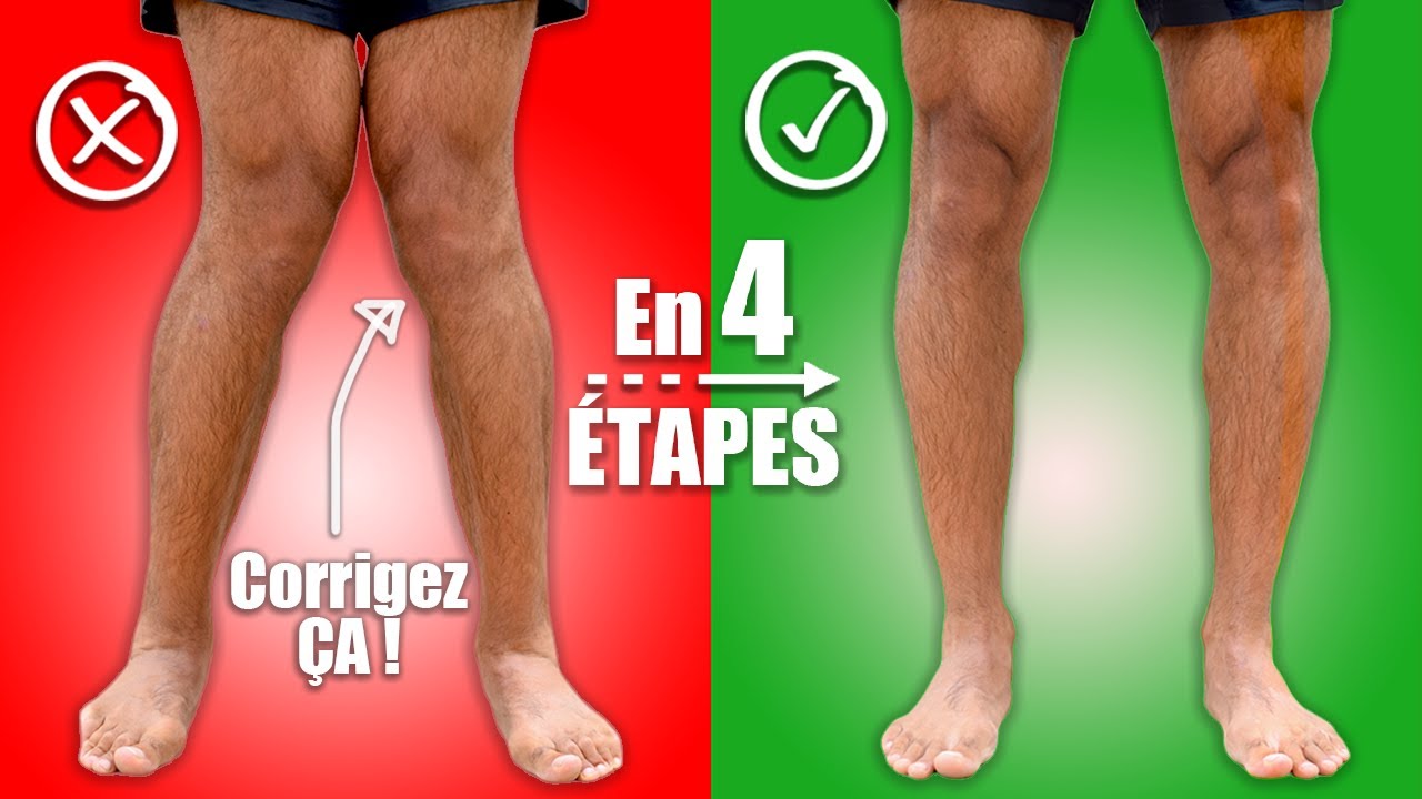 Sciences du Sport  Valgus du genou : quelle est l'efficacité des