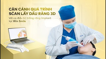 Cận cảnh quá trình lấy dấu răng 3D trong Implant| Nha khoa Win Smile