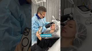 Коррекция межбровья