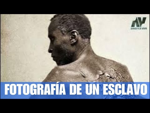 "Flogged Peter," the slave whose heartbreaking photograph changed the perception of slavery