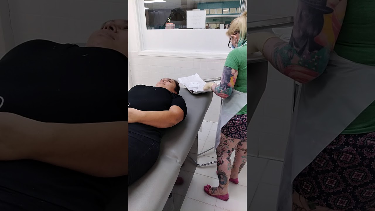 Christians Cheekbone Dermal Piercing! Tommy T's Body Piercing Huntington Beach, CA