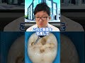 コンポジットレジン治療を先生が説明!