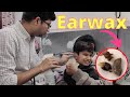 Earwax removal from children  how to remove hard wax from small children  otoscaopy