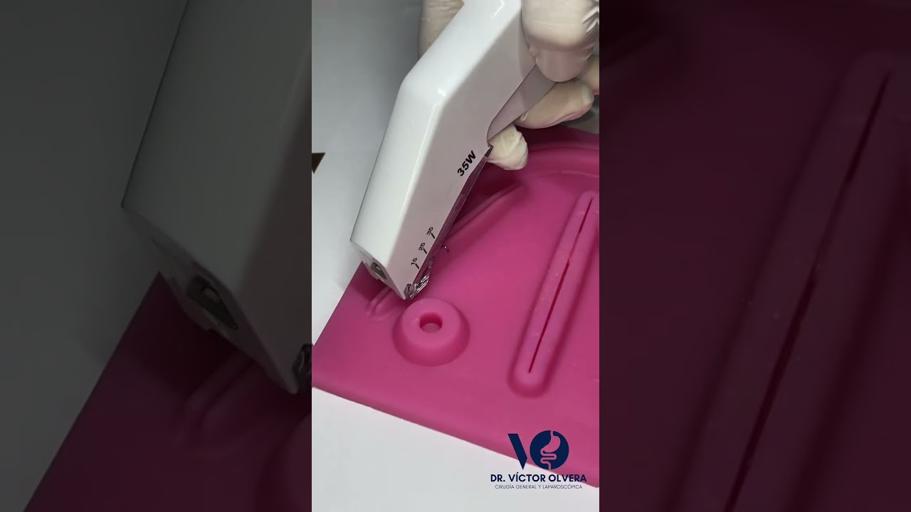 Surgical Skin Staplers: How do they work? #medicine #medical #tech #skin #stapler #stitches #surgery