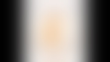 Preeti Hospital - Best Urologist in Hyderabad Live Stream - Laparoscopic Pyelolithotomy