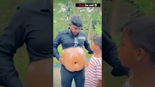 Injection Makes Brother Belly Big P2