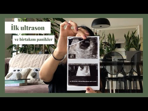 Hamilelikte Toksoplazma  | İlk Ultrason  | Aralıklı Oruç  | Mide Bulantısı??