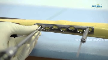 Dynamic Compression Locking Plate- DCP BROAD