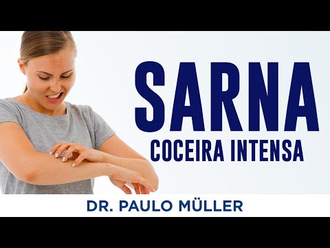 Sarna ou Escabiose – Doença que Causa Coceira Intensa – Dr. Paulo Müller Dermatologista.